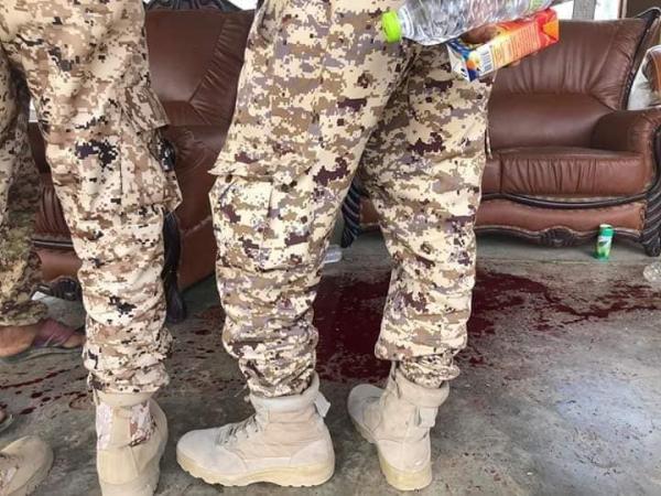 شاهد عيان يروي تفاصيل الانفجار الذي استهدف منصة العرض بقاعدة العند
