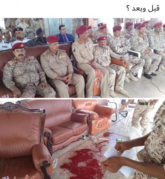 شاهد صورة منصة العند قبل وبعد استهدفها من قبل الحوثيين