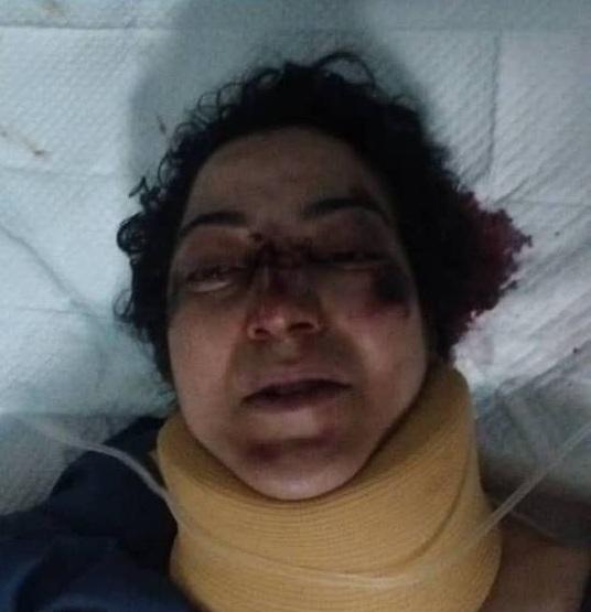 إصابة امرأة في حادث مروري في الستين بصنعاء .. مطلوب التعرف عليها (صورة)