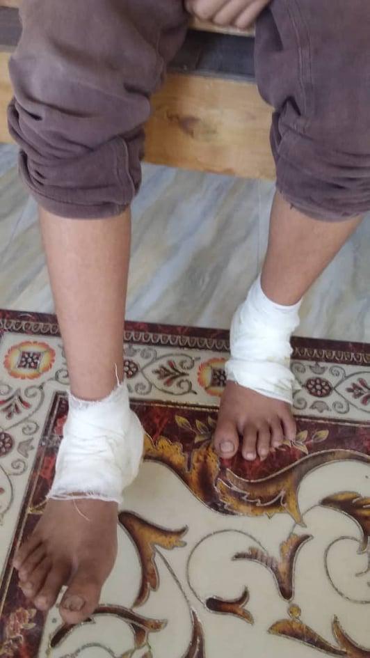 تاجر في الحديدة يتلذذ بتعذيب طفل ويوثق لحظة إحراق وأشعال النار في جسده (شاهد)