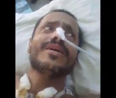 بالفيديو: جماعة الحوثي تفرج عن صحفي في صفقة تبادل اسرى وهو مشلول بالكامل