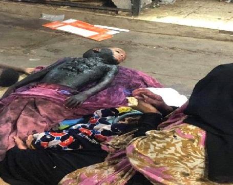 ضبط إمرأة تقوم بأغرب وسيلة للتسول في الشيخ عثمان بعدن (صورة)