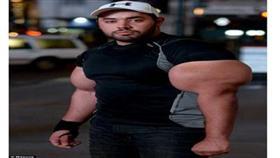  بالصور.. مصري يحاول دخول "جينس" بأكبر وأغرب عضلات