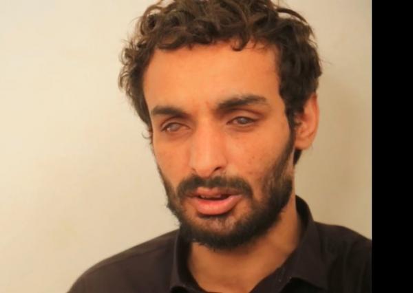طرق بشعة عذبت جماعة الحوثي هذا الشخص حتى فقط بصرة (شاهد)