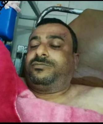 اغتيال قيادات حوثية بارزة في محافظة إب (الاسماء)
