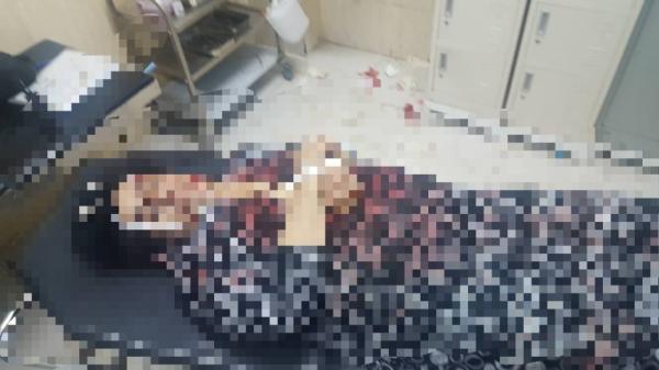 التفاصيل الكاملة لمقتل امراة داخل فندق بعدن