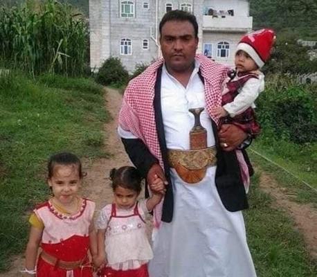 وفاة مختطف مُفرج عنه في إب متأثراً بالتعذيب في سجون الحوثي