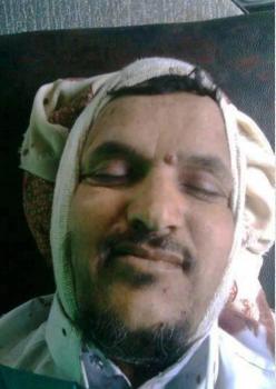 صورة خطيب الجامع الشاب الذي قتله الحوثييون اليوم وهو مبتسم: ارتفاع عدد القتلى الى   6 في مديرية ريدة