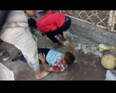 أكثر من 20 مدنياً قتيلا وجريحا بقصف حوثي في مدينة الحديدة