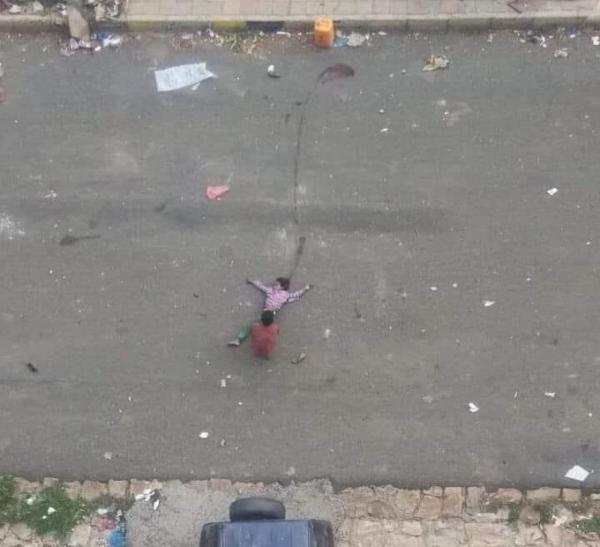 الطفلة «رويدا» تشعل مواقع التواصل الاجتماعي بعد قيام قناص حوثي بقنصها بالرأس (شاهد)