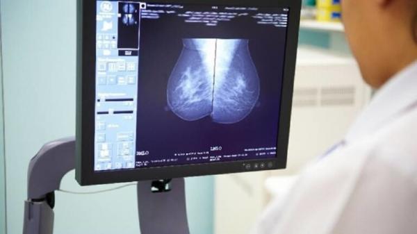 دراسة جديدة تكشف عن جرعة إشعاع واحدة بدلا من أسابيع علاج إشعاعي لسرطان الثدي