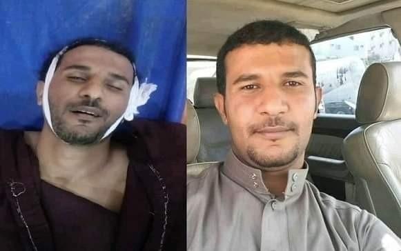 قوات تابعة للإصلاح في تعز تصفي مواطن بعد قيامها بالاستيلاء على منازله