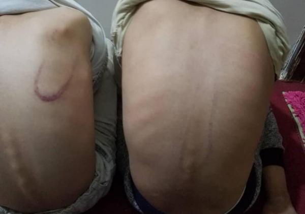 اقتحام عسكري لبيت مستأجر بصنعاء وضرب أولاده وزوجته وشج رأسها لاخراجهم منها بالقوة (صور)
