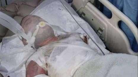 احراق مواطن في إب أمام الملأ