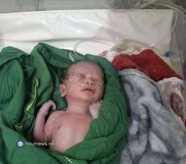 قصف حوثي في تعز يتسبب بإصابة امرأة في شهرها التاسع وعملية لانقاذ الجنين