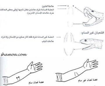 كيف تفرق بين الثعبان السام وغير السام؟