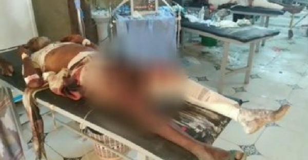 سقوط ضحايا جراء قصف استهدف حي منظر جنوب مدينة الحديدة