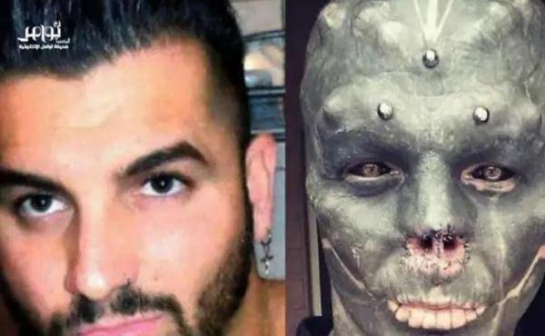 واقعة صادمة.. شاب يقطع أنفه وشفته العليا ويشق لسانه .. والسبب غريب!