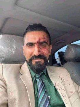 المحامي وضاح قطيش يتعرض لاعتداء وحشي داخل محكمة جنوب غرب صنعاء (صور)