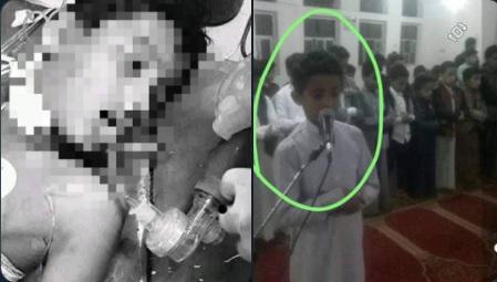 مقتل طفل نازح من تعز في إب برصاص مرافق شيخ قبلي