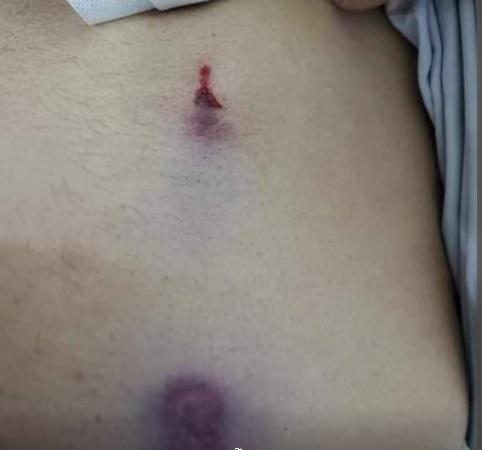 الإعلان عن 7 قتلى و27 جريح في صنعاء بسبب الرصاص الراجع نتيجة الاحتفال بالرصاص الحي