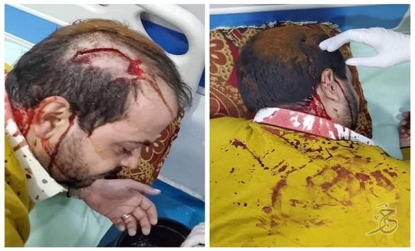 حوثيون بصنعاء يعتدون على رجل الأعمال أحمد الكبوس (صور)