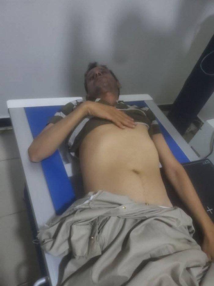 ناشط حوثي يتعرض لهجوم وضرب مبرح عقب كشفه عن قضايا فساد بصنعاء