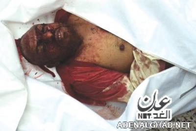 مسلحين هاجموا رتلاً عسكرياً يتبع اللواء 33 وسيطروا على ناقلة محملة بالسلاح.. الضالع.. مقتل "3" وإصابة 6 آخرين بينهم طفلة والقبض على "6" جنود والاستيلاء على طقمين