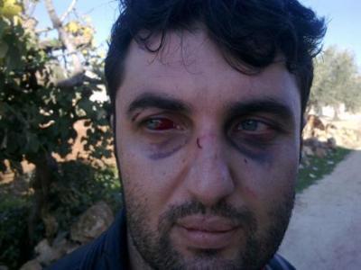 معتقل سوري يكشف "جحيم" المخابرات الجوية لنظام بشار الأسد