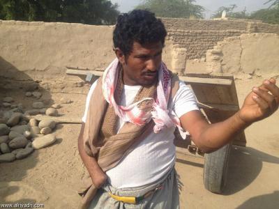 شاب يمني من (الأخدام) يروي معاناته بعد بتر تنظيم القاعدة يده