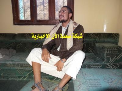 صورة شاب أعتقله الحوثيون قبل 67 يوماً وأفرجوا عنه يوم الأحد الماضي فاقداً للعقل "مجنون " 