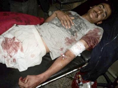 شاب يمني يروي قصة اختطافه واجباره على ادخال متفجرات الى ساحة التغيير