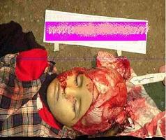 ثاني ابشع جريمة اغتصاب في اقل من شهر تهز اليمن 