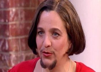 بالصور.. امرأة ألمانية بلحية منذ 20 عاماً