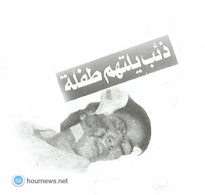 قصة طفلة قاومت ذئباً بشرياً فشووه وجهها