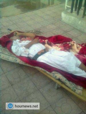 عاجل : القبض على متهم بقتل أخيه في منطقة بني عواض بمديرية العدين - صورة القتيل 