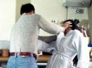في الحديدة.. زوج عض زوجته حتى أسال الدم وأحرق جسدها بالسجائر (زوج مع والدته يتفننون في تعذيب زوجته).