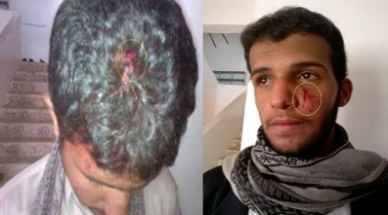  تواصل انتهاكات الحوثيين بصعده ضد المواطنين، والحوثييون يشترون صمت المنظمات الحقوقية