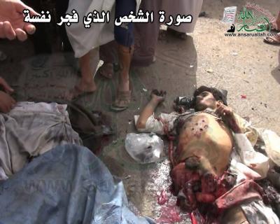 "صورة لقائد الدراجة النارية بعد التفجير" مصادر أمنية : تفجير صعدة ناتج عن لغم يحمله أحد مسلحي الحوثي وليس إنتحارياً