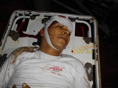 نجاة احد نزلاء السجن المركزي من حادثة احراق نفسه ومقتل مواطن  بتعز