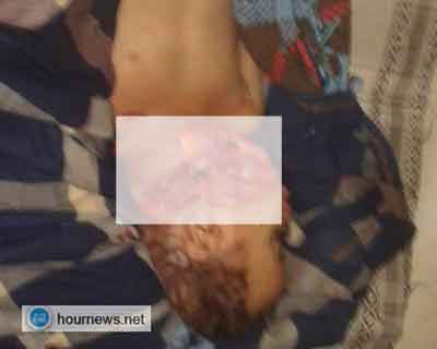 اب يذبح نجله البالغ سنتين من عمره بتعز "صورة"