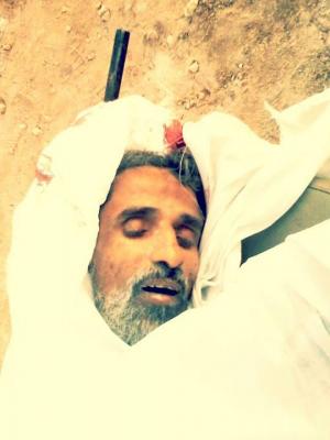 "جزء من سيرته الذاتية وصورته" ماذا كتب محمد نعمان قريب الشهيد عبد الفتاح نعمان الطبيب اليمني الذي قُتل في سوريا