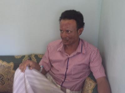 الضالع: متعاقد يحرق نفسه إحتجاجاًُ على إلغاء تعاقده وحرمانه من مستحقاته بالمواصلات الضالع: متعاقد يحرق نفسه إحتجاجاًُ على إلغاء تعاقده وحرمانه من مستحقاته بالمواصلات