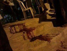 في مطعم الكورنيش حضرموت مجهولين يغتالون العقيد محمد علوي الحبيشي بالرصاص في دراجة نارية (صور)