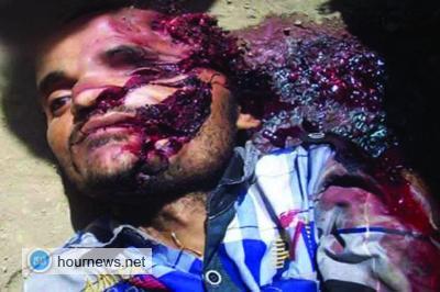 الضالع :حالة إنتحار مؤلمة في منطقة العود بقعطبه (صورة)