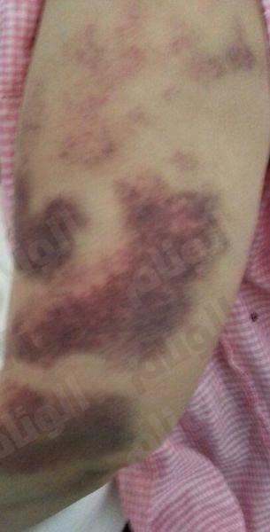 زوج مُعنِف يحتجز زوجته يوماً كاملاً ويُوسعها ضرباً بمكة .. والدفاع المدني يفك احتجازها