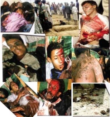  احصائية .. حروب الحوثيين خلفت 28 الف قتيل و60 الف جريح و700 الف نازح 