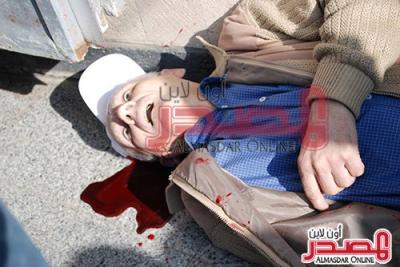 مقتل خبير عسكري روسي وإصابة آخر برصاص مسلح يستقل دراجة نارية في صنعاء (صورة)