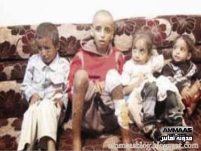 تفاصيل تحرير ستة أطفال تعرضوا للحبس والتعذيب على يد أبيهم