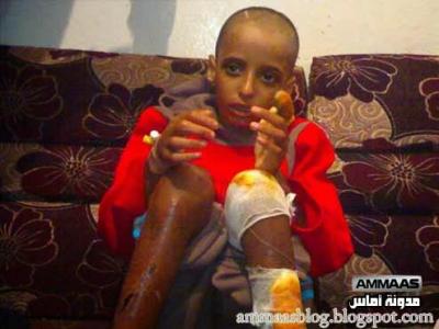 تفاصيل تحرير ستة أطفال تعرضوا للحبس والتعذيب على يد أبيهم